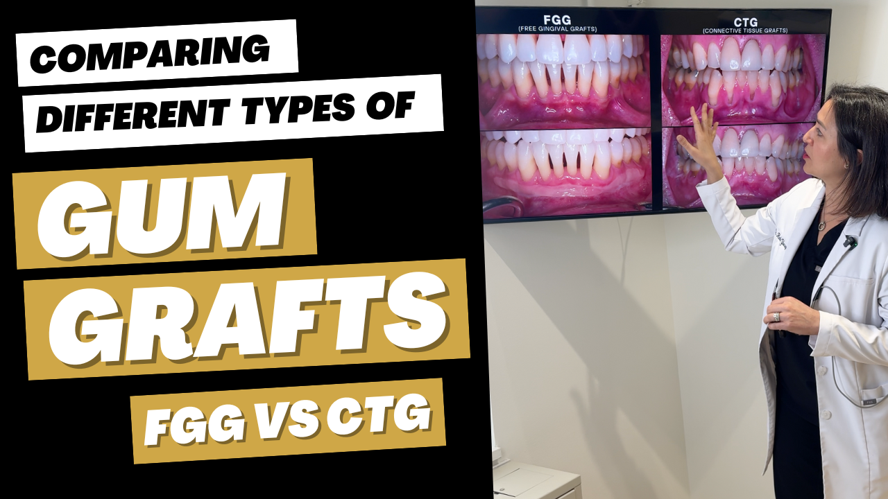 Comparing Different Types of Gum Grafts #gumgraft #gumrecession #periodontist #washingtondc #dentist