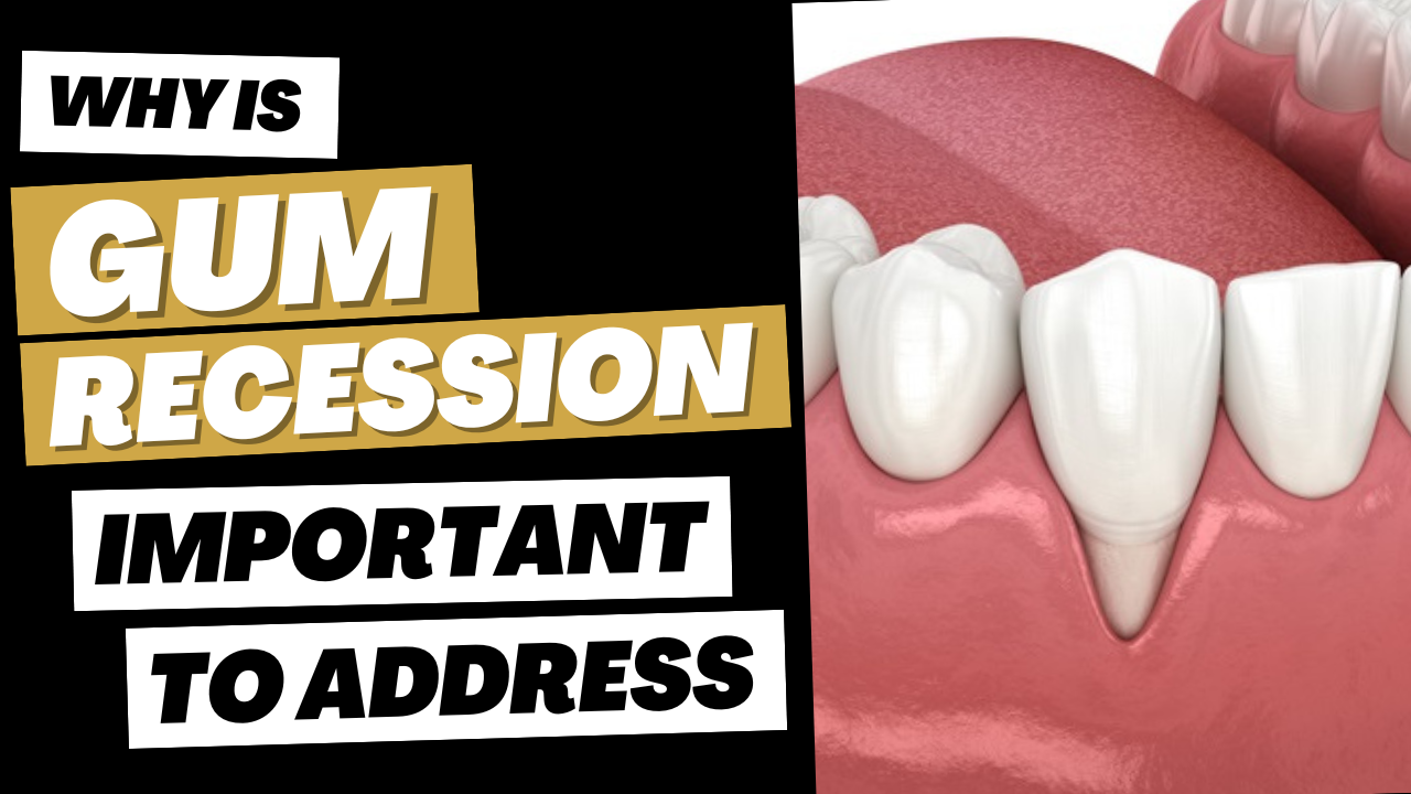 Why is Gum Recession Important to address? #gumgraft #washingtondc #dentist #gumgrafting