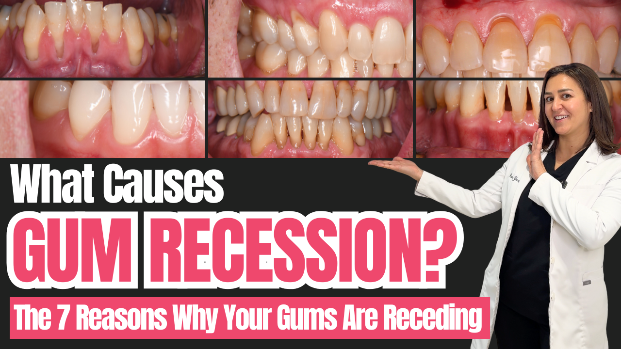 What Causes Gum Recession? Dr. Raha Yousefi Explains The Real Reasons Behind Receding Gums